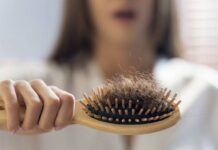 Calvicie: Tips para evitar la caída del cabello