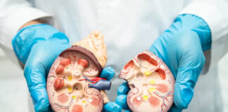 La insuficiencia renal es una enfermedad catastrófica en México